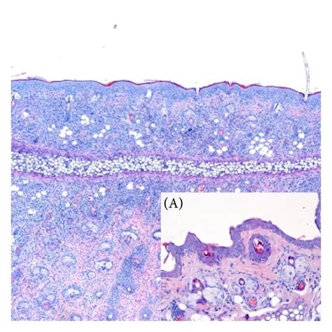 Histological Evaluation Of Skin Samples Representative Microscopic Download Scientific Diagram