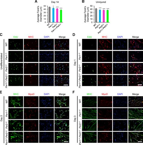 Regeneration Of Ta Muscle And Myoblast Differentiation Comparing