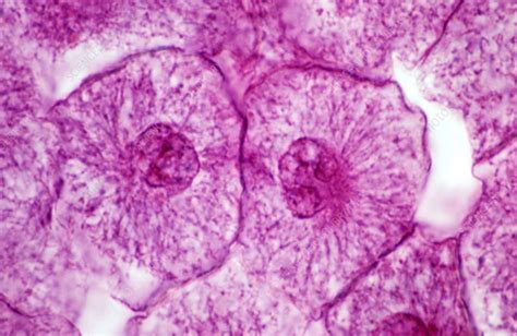 Interphase stage of mitosis, LM - Stock Image P673/0081 - Science Photo Library