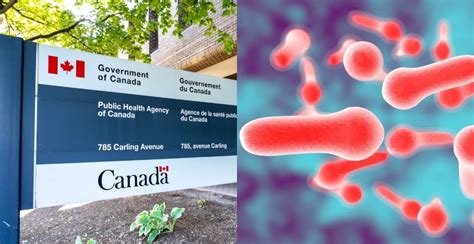 Public Health Agency of Canada investigating suspected botulism ...