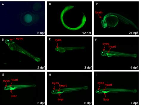 Gfp Expression Patterns In The Eye Line Generated By The Pb Mediated