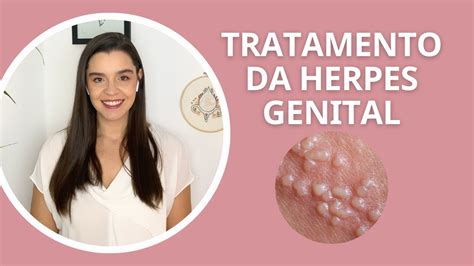 A Herpes Genital Tem Cura - Tratamento da herpes genital, como tratar herpes genital - YouTube