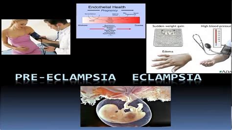 PRE-ECLAMPSIA / ECLAMPSIA - YouTube