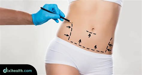 Tummy Tuck Surgery In Turkey Istanbul With Good Price