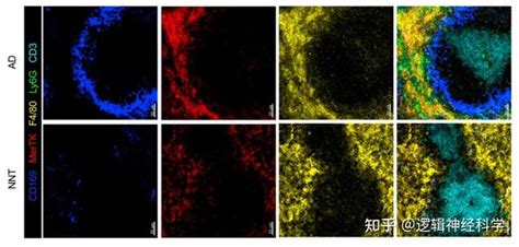 Immunity︱纽约大学格罗斯曼医学院团队发现：新生儿通过中性粒细胞补体调理吞噬作用抵抗肺炎链球菌感染 知乎