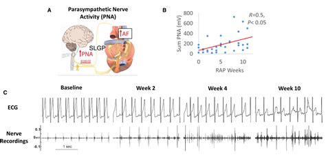 Use Of Atrial Fibrillation Electrograms And T T Magnetic Resonance