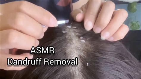 Asmr Do A Scalp Check And Dandruff Removal Super Tingly Scalp Massage