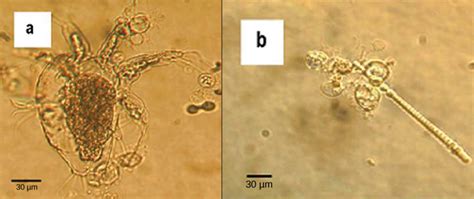 Chytridiomycota The Chytrids Biology For Majors Ii