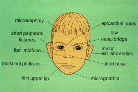 Special Education Disability Laws Flashcards Quizlet