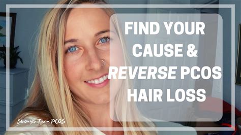 Can Hair Loss From Pcos Be Reversed Rebuild Hair Program Does It Work