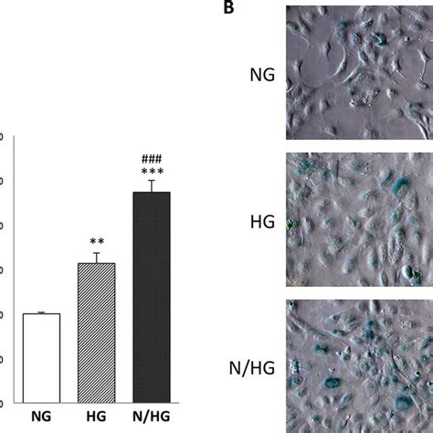 Enos Activity In Huvecs Exposed To High Glucose Ng Constant Normal Download Scientific