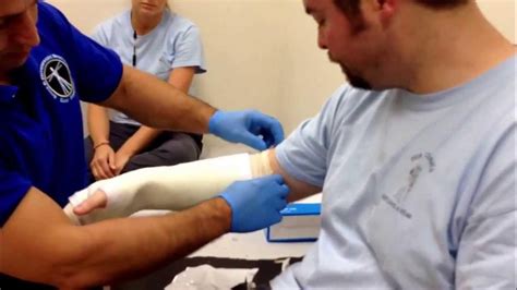 Short Arm Cast Application By Dr Grimaldi Youtube