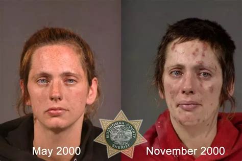 Faces Of Meth Horrific Transformation Of Fresh Faced Adults Into