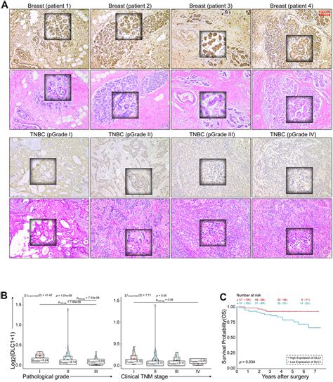 The Oncogenic Mir Promotes Triple Negative Breast Cancer