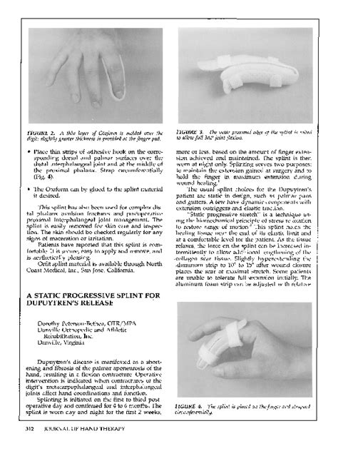 Pdf A Static Progressive Splint For Dupuytrens Release Dorothy Bethea