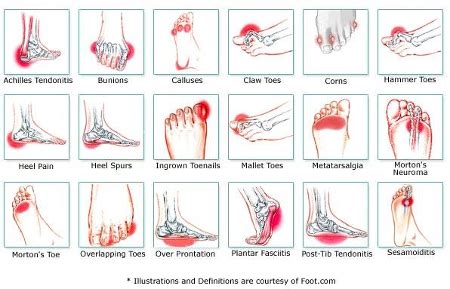 Foot Pain Diagnosis