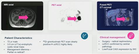 Asco Gu Zircon Results From Phase Study Of Zr Dfo