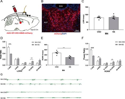 Pvt Glutamatergic Neurons Inhibition Delays Emergence From Isoflurane Download Scientific