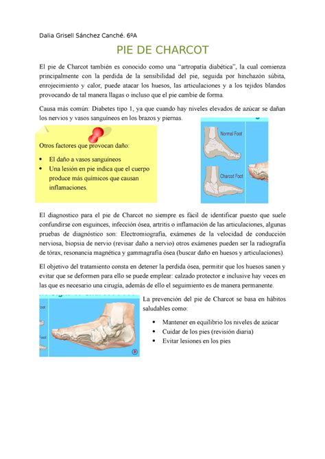 Descripci N Del Pie De Charcot Dalia Grisell S Nchez Canch A Pie