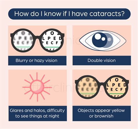 Cataract Symptoms : How Do You Know If You Have Cataract?