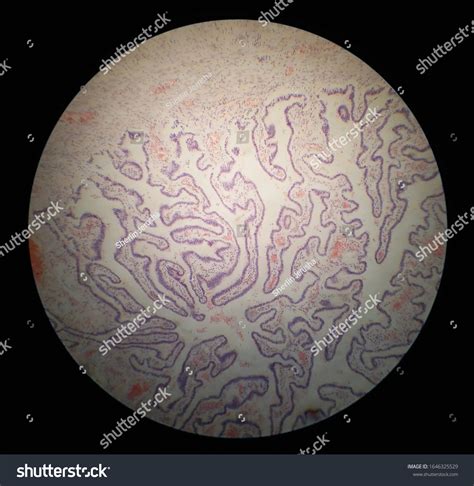 Histology Specimen Human Oviduct Cells Under Stock Photo 1646325529 ...