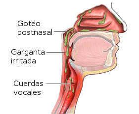 Sensaci N De Mucosidad En La Garganta Normalweb Es