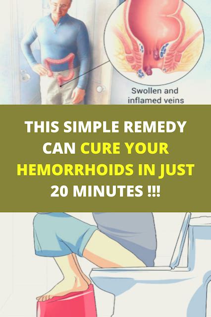 This Simple Remedy Can Cure Your Hemorrhoids In Just 20 Minutes