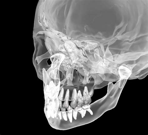 Human child skull anatomy model with individual teeth 3D model 3D ...