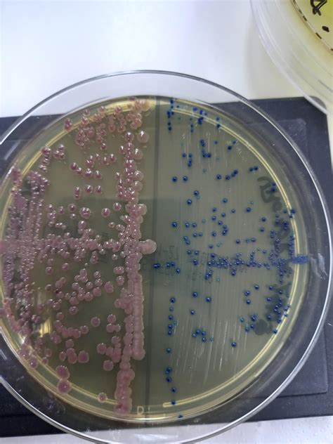 Escherichia coli from urine culture : r/microbiology