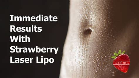 Strawberry Laser Lipo Procedure With Trish Siegrist