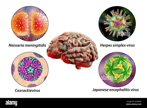 Infections C R Brales Illustration Informatique Des Micro Organismes