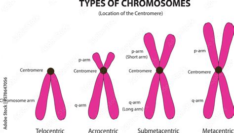 chromosome types Stock Vector | Adobe Stock