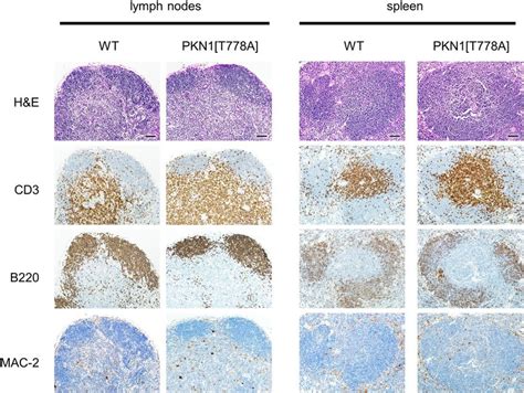 Histological Analysis Of Secondary Lymphoid Organs Representative