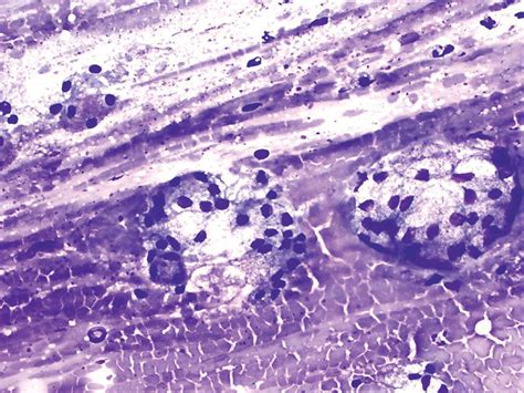 Cytology of the Lymph Nodes | Veterian Key