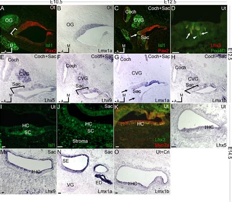 Diverse Expression Patterns Of Limhomeodomain Transcription Factors