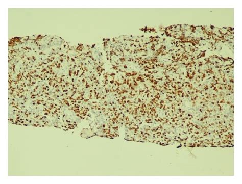 Renal pathology. Renal cortex replaced by medium-sized to large ...