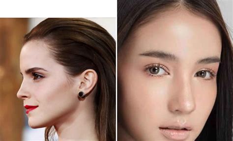 Female Vertical Flat Forehead Shape - Explore Plastic Surgery