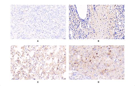 Expression Of Apelin In Ppgls A Negative Immunostaining Of Apelin