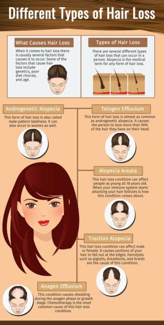 Ppt Different Types Of Hair Loss Powerpoint Presentation Free Download Id7259392