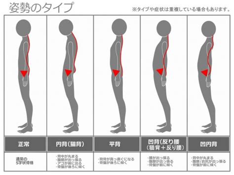 股関節の痛み鼠径部、臀部の痛み 羽曳野の整体【口コミ地域№1整骨院】もりつか整骨院