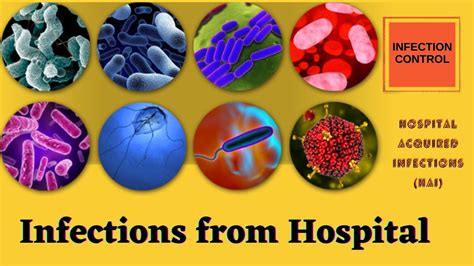 Preventing Hospital Acquired Infections Nosocomial Infections