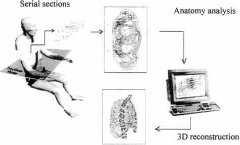 3d Reconstruction Method Of Anatomical Elements Chabert[ Lo] Download Scientific Diagram