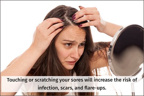 How To Treat Scalp Sores Emedihealth