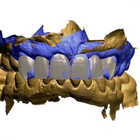 CAD/CAM Systems – Ceramics Dental Lab North Miami Beach