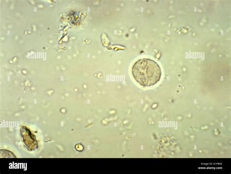 Entamoeba Histolytica Under Microscope