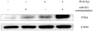 Phosphatase And Tensin Homolog Pten Expression Was Promoted In Micro