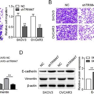 Trim Knockdown Inhibited Ovarian Cancer Cell Migration Invasion And