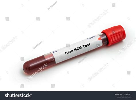 Beta Hcg Test Medical Check Test Stock Photo Shutterstock