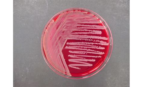 Burkholderia Cepacia Selective Agar Supplement