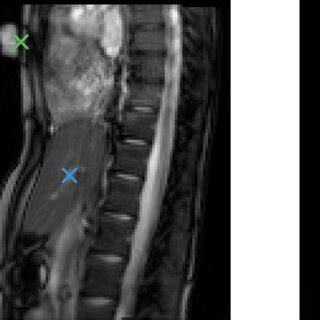 Example Of A Pair Of D Mr Sagittal Slice Images The Positions Of The